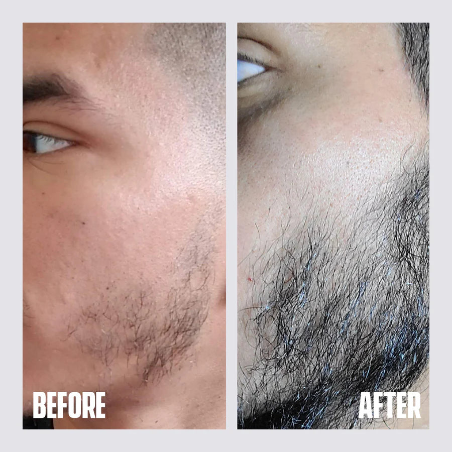 Zulf Beard Growth Serum Unlock Fuller Thicker Beards